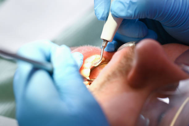 Best Walk-In Emergency Dentist in Manitou Springs, CO